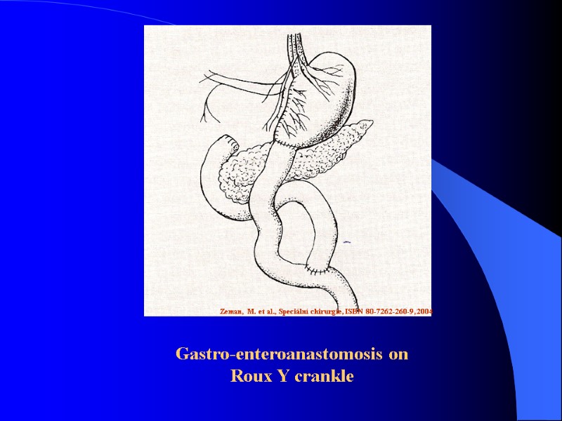 Zeman, M. et al., Speciální chirurgie, ISBN 80-7262-260-9, 2004 Gastro-enteroanastomosis on Roux Y crankle